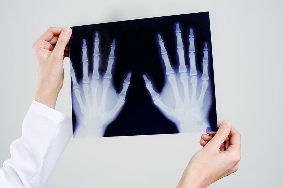 diagnostyka stawów dłoni